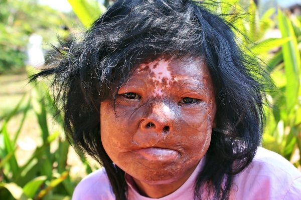 Zdjęcie z Kambodży - Ofiara min Kambodża
