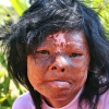 Zdjęcie z Kambodży - Ofiara min Kambodża